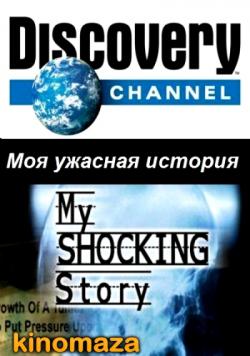    / My shocking story